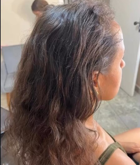 Cabelo antes do tratamento e corte